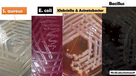 e coli in fish|What is the most common bacterial path.